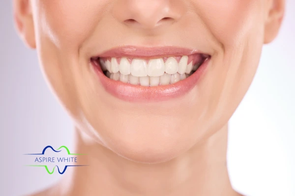 Follow your teeth whitening aftercare Hinckley to prolong your whiter smile!